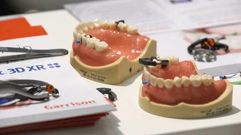 Model of human jaw with dental samples of fasteners on the stand. Stock Footage 70335369