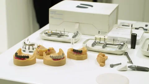 Model of human jaw with samples of dental crowns on the stand. Stock Footage 165891298