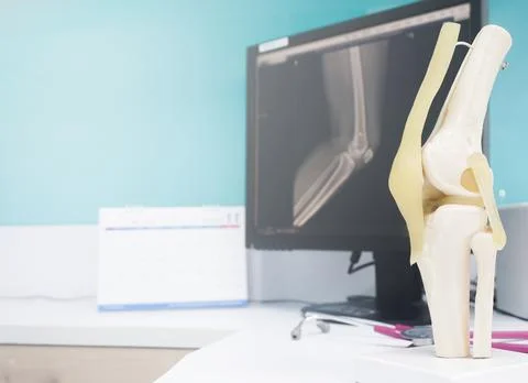 Model of Human knee and leg with stethoscope for medical education and x-ray  Stock Photos