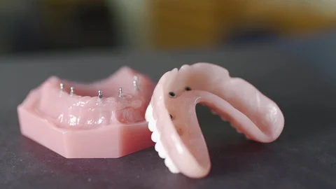Model of implant secured denture on a counter top Stock Footage 113749793