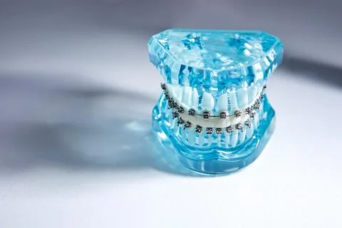 Model of a man's jaw with braces. False teeth. The concept of care for the or Stock Photos