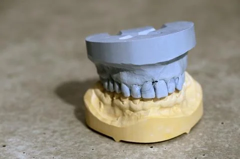Model of a set of teeth with upper and lower jaw Stock Photos