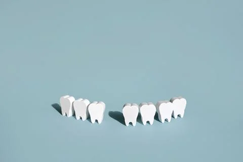 A model of teeth on a blue background with a missing front tooth . Stock Photos