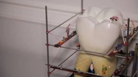 Model of the teeth Stock Footage 63303970