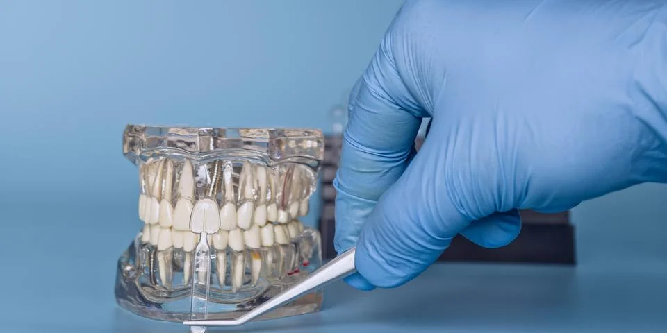 Model of teeth with sample size and hand in glove Stock Photos