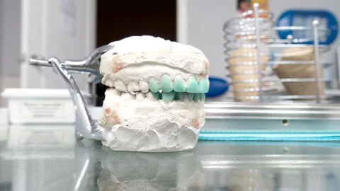 Modeling of artificial teeth on a plaster model Stock Footage 344167108