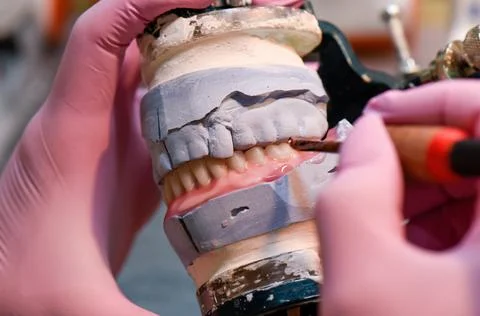 Modeling the installation of a denture with wax close up. Stock Photos
