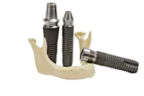 Models of dental titanium implants and plastic human jaw Models of dental ... Stock Photos