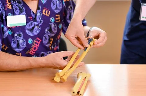 Models of the radial bones of the hand Foto stock