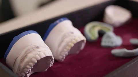 Models of teeth in dental office Video stock 113472520