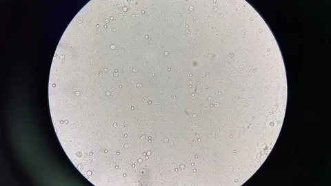 Moderate Bacteria moving in urine. Stock Footage 217701752