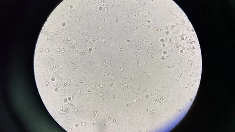 Moderate Bacteria moving in urine. Stock Footage 217702129