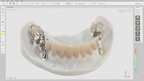 Modern CAD Software Used For Dentistry P... | Stock Video | Pond5