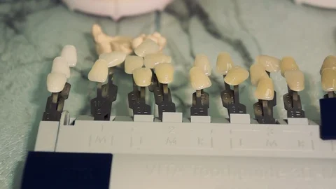 Modern examples of dental implants Stock-Footage 128710831