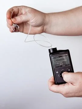 Modern insulin pump device and sensor technology for diabetes management Stock Photos