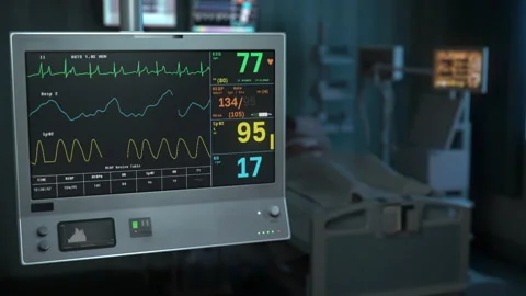 Modern machine is checking the vital signs of the coma patient at the clinic Stock Footage 169564441