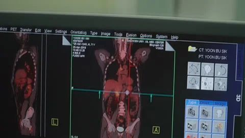 Modern methods of analysis and human research. Medical Screens with indicat.. Stock Footage 335650860