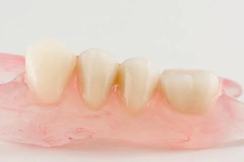 Modern nylon removable dentures Stock Photos