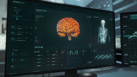 Modern Software For X-ray Of Examination Of A Patient Skull Without Doctor Help Stock Footage 158298109