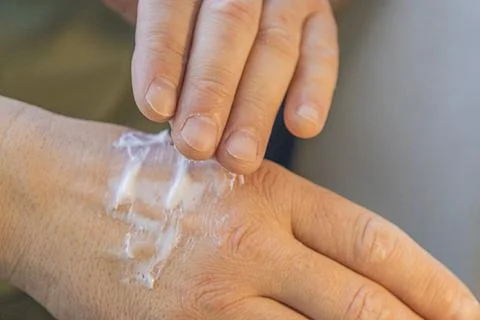 Moisturizing Cream Applied On Hand Foto stock