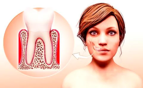 Molar tooth, artwork Stock Illustration