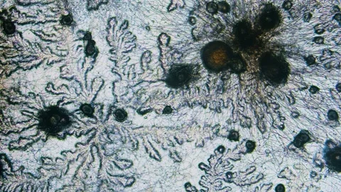 Mold and bacteria Stockbeeldmateriaal 313615456