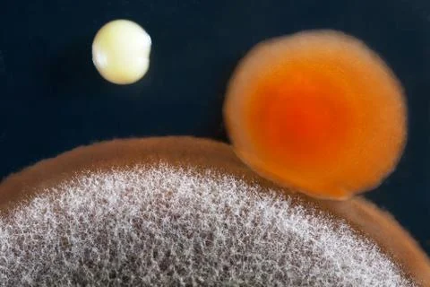 Mold and bacteria Stock Photos