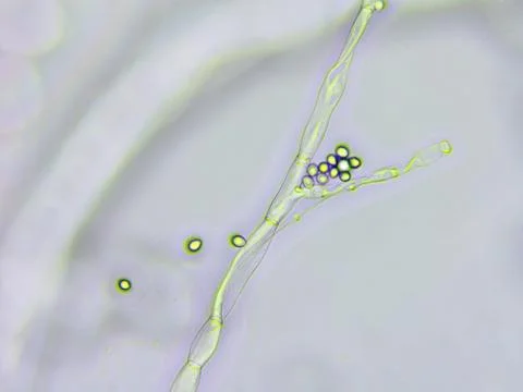 Mold microscopic view Stock Photos