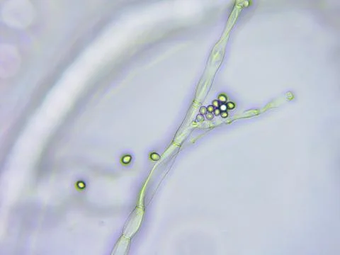 Mold microscopic view Stock Photos