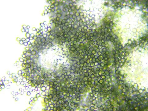 Mold microscopic view Stock Photos