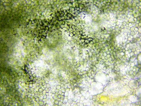 Mold microscopic view Stock Photos