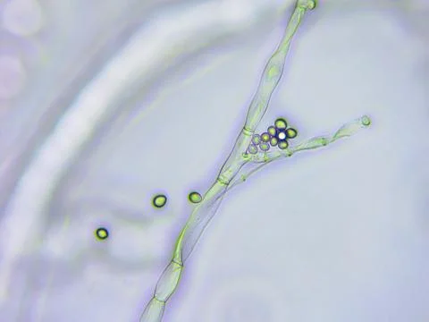 Mold microscopic view Stock Photos