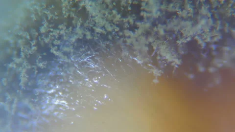 Mold under the microscope. GMO. DNA. Black Mold taken from rotten bread , und Stock Footage 107360091