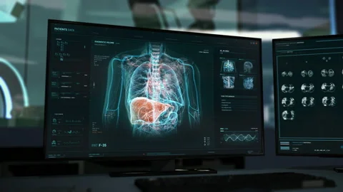 Molecular Analysis Software In Hospital Checks Respiratory Organ For Illness Vídeo Stock 201051612