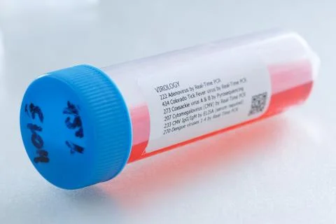 Molecular diagnostic (pcr) testing Stockfoto's