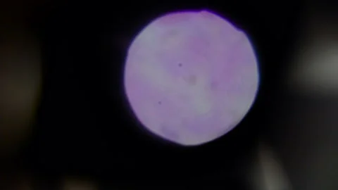 A molecule of gonorrhea through a microscope Stock Footage 99950971