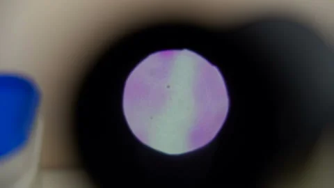 A molecule of gonorrhea through a microscope Stock-Footage 101425484
