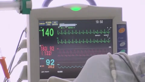 Monitor Of The Artificial Lung Ventilation Device On The Monitor That Displays Stock Footage 157506301