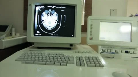 Monitor of computerized tomography Stock Footage 12721047