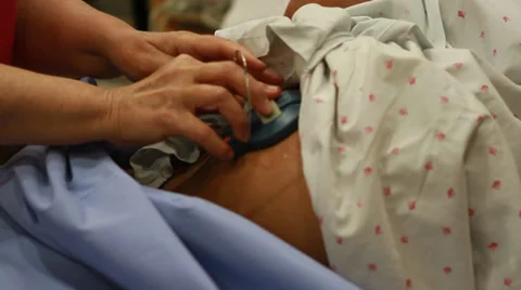 Monitor in  delivery room Vidéo 39349081