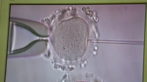 Monitor Demonstrates Process of Artificial Fertilization of Female Egg. IVF Stock Footage 147005327