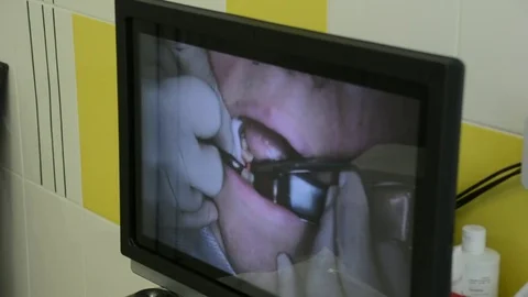 Monitor in dentistry Stock Footage