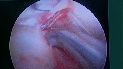 Monitor endoscope 스톡 동영상 72567319