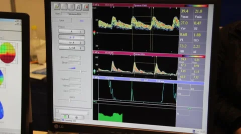 Monitor Stock Footage 878601