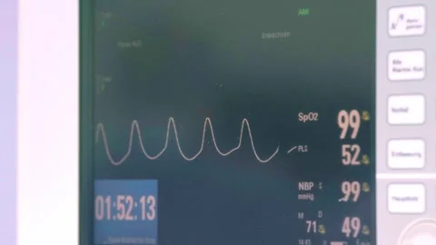 Monitor of the heart rhythm in the operating room. Stock Footage 270552748