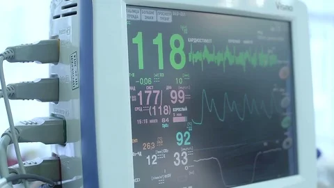 Monitor of indications of action of heart, frequency and amplitude of reductions Stock Footage 73287780