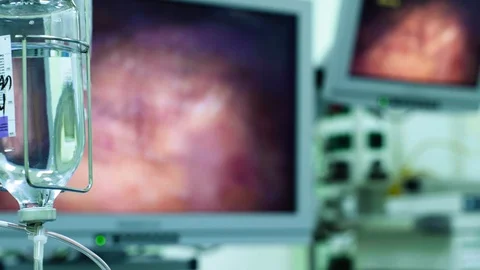 Monitor of laparoscope during the operation. Stock Footage 88637917