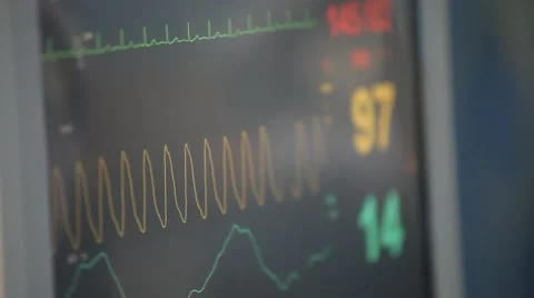 The monitor of life support device (reading pulse, oxygen, blood pressure) Stock Footage