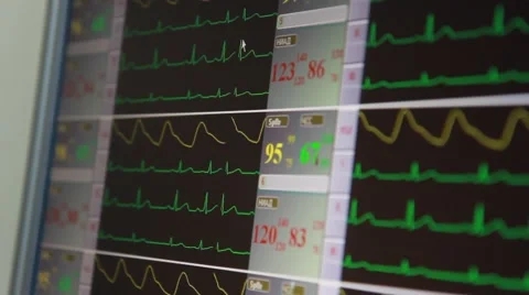 The monitor of life support device (shows pulse, oxygen, blood pressure) Stock Footage 45456894