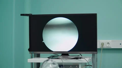 Monitor in the operating room 스톡 동영상 164312875